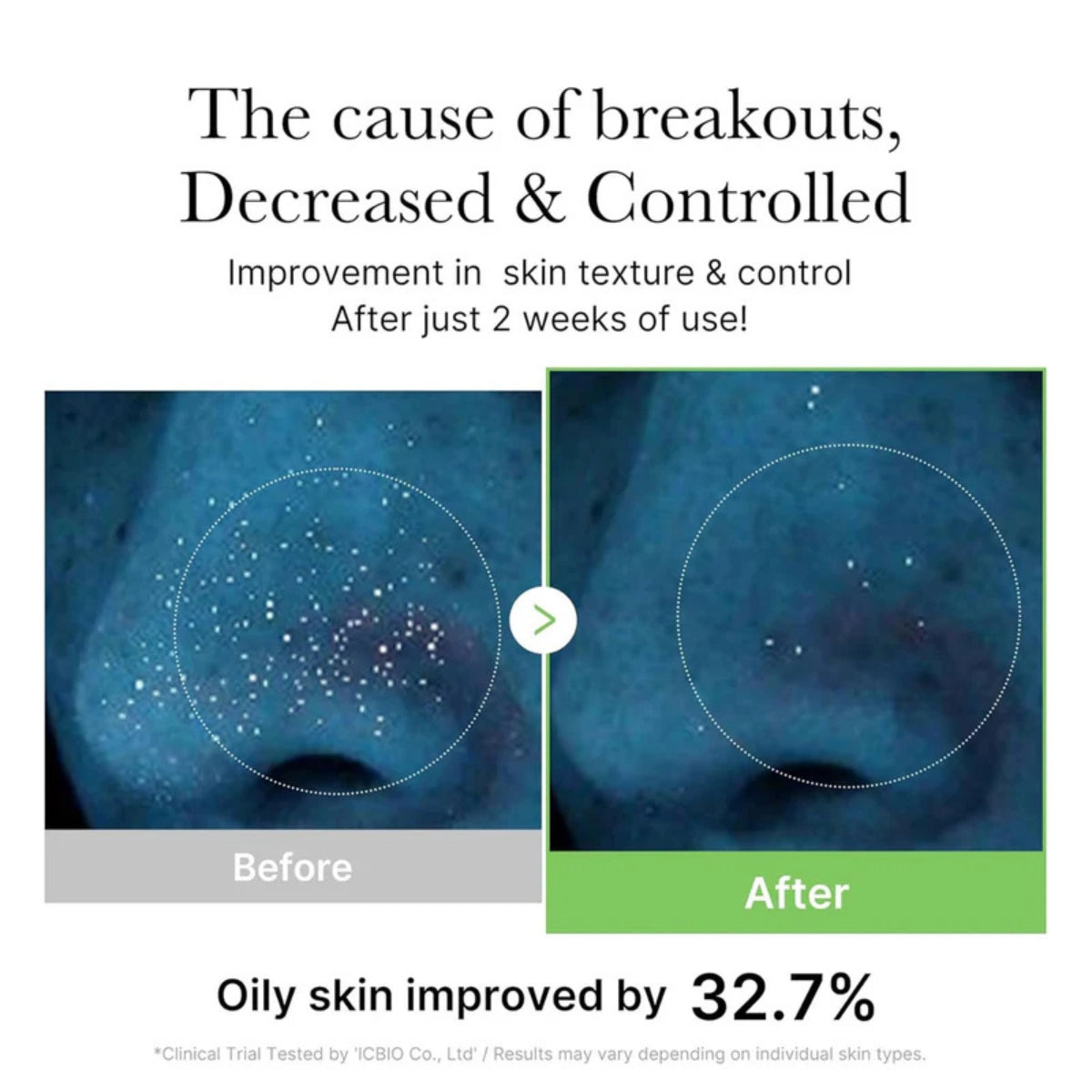 MEDICUBE Exosome Cica Toner 210Ml - Bulk Buy K-Beauty in Australia