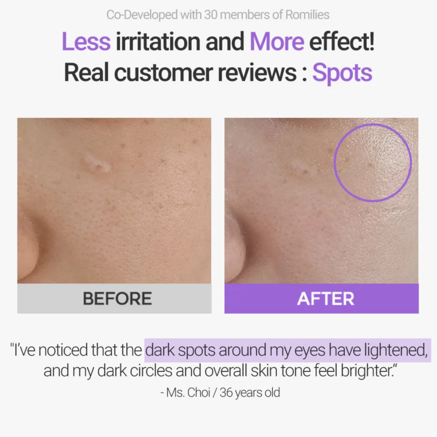 Rovectin Retinosine Deep Intense Cream 30ml