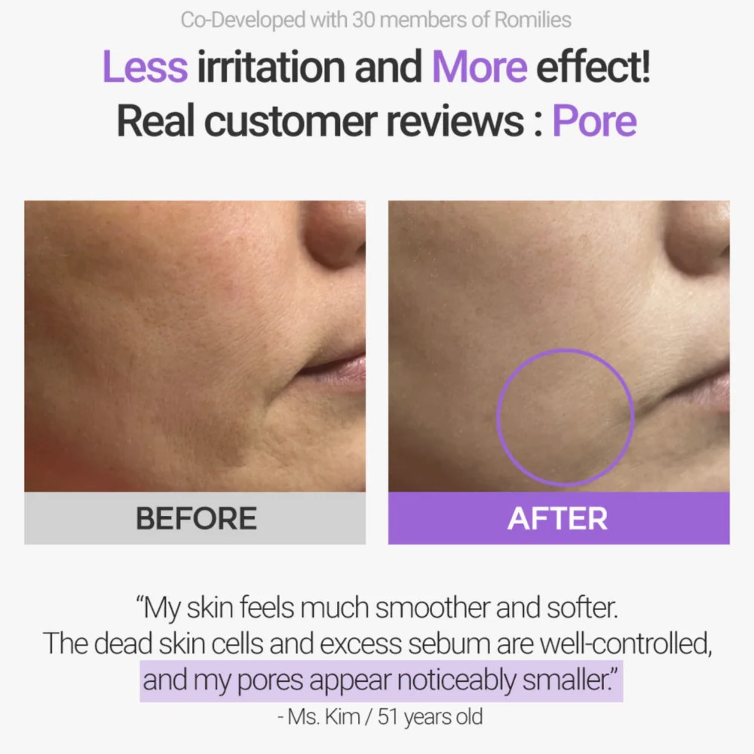 Rovectin Retinosine Deep Intense Cream 30ml