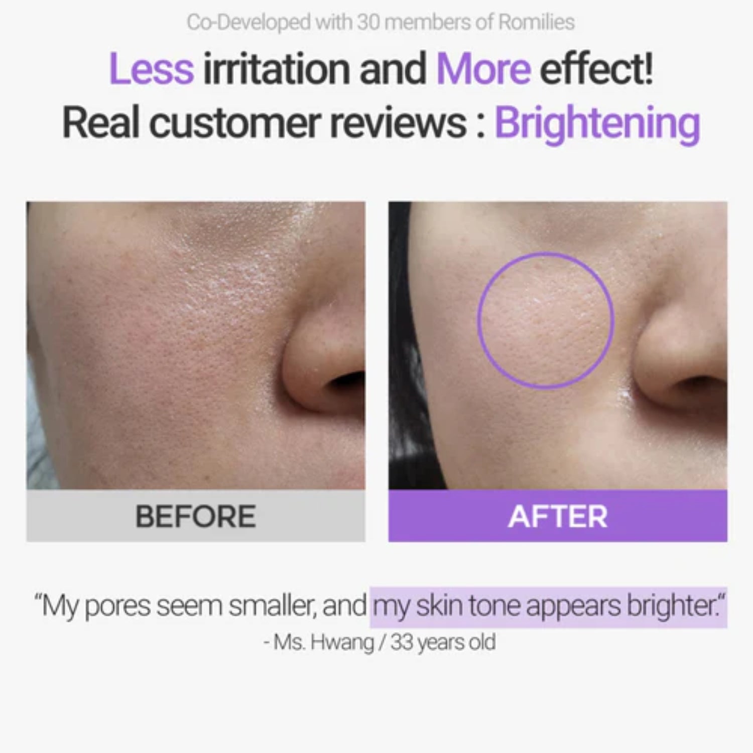 Rovectin Retinosine Deep Intense Cream 30ml