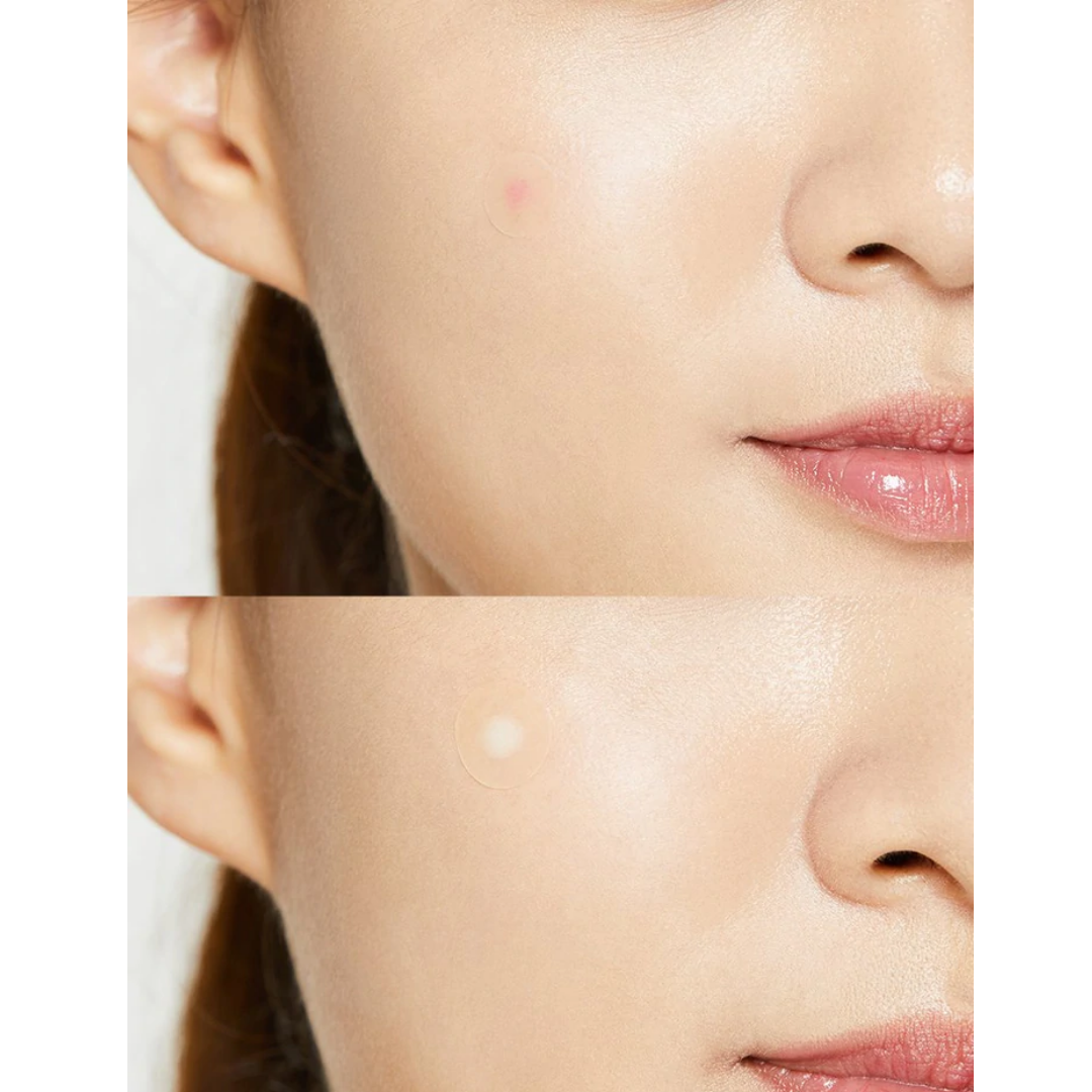 COSRXAcne Pimple Master Patches (24 Patches)  - Pharmacoo K-beauty Wholesale