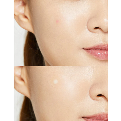 COSRXAcne Pimple Master Patches (24 Patches)  - Pharmacoo K-beauty Wholesale