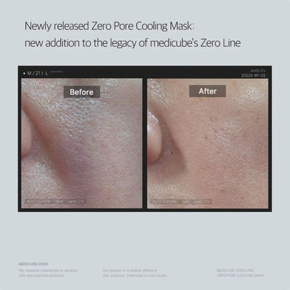 MEDICUBE Zero Pore Cooling Mask 27G 1Pc - Bulk Buy K-Beauty in Australia