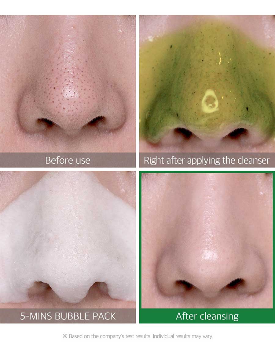 Some By MiBye Bye Blackhead 30 Days Miracle Green Tea Tox Bubble Cleanser - La Cosmetique